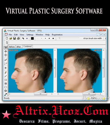 Virtual Plastic Surgery Software 2009 v1.0 Portable.